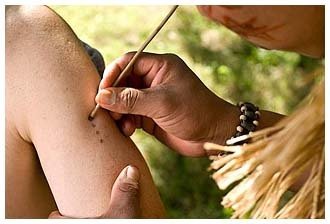 applying kambo queen of the forest jungle medicine sapo ceremony healing the tribe tree-frog